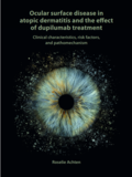 Thesis cover: Ocular surface disease in atopic dermatitis and the effect of dupilumab treatment