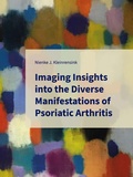 Thesis cover: Imaging Insights into the Diverse Manifestations of Psoriatic Arthritis