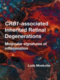 Thesis cover: CRB1-associated Inherited Retinal Degenerations
